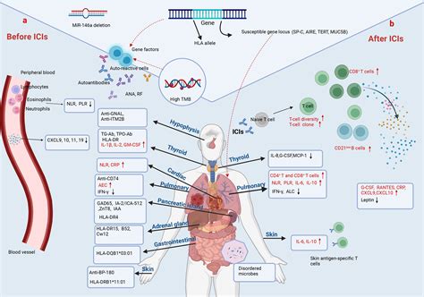 Elderly People Diseases: Comprehensive Guide to Managing Chronic Conditions