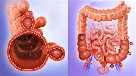 Understanding UTI Infections in Elderly: Causes, Symptoms, and Prevention